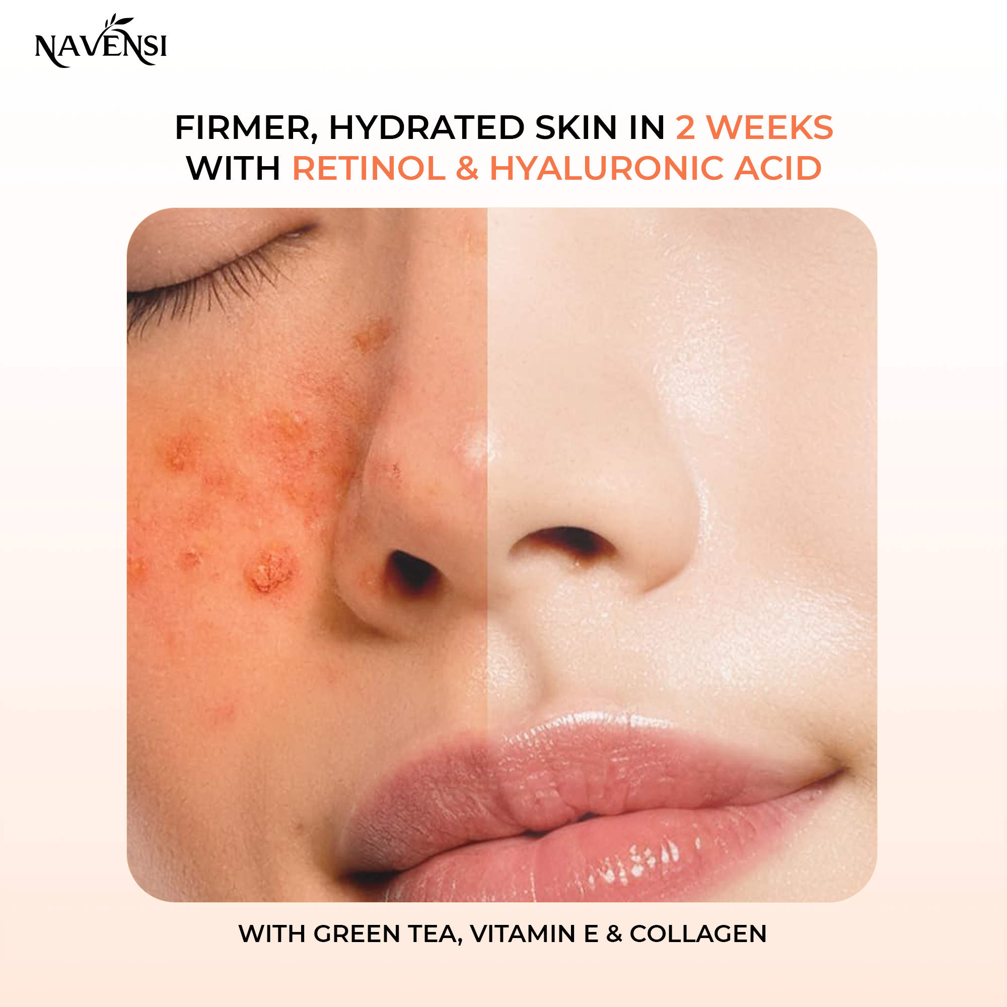 NAVENSI Retinol & Hyaluronic Acid Cream